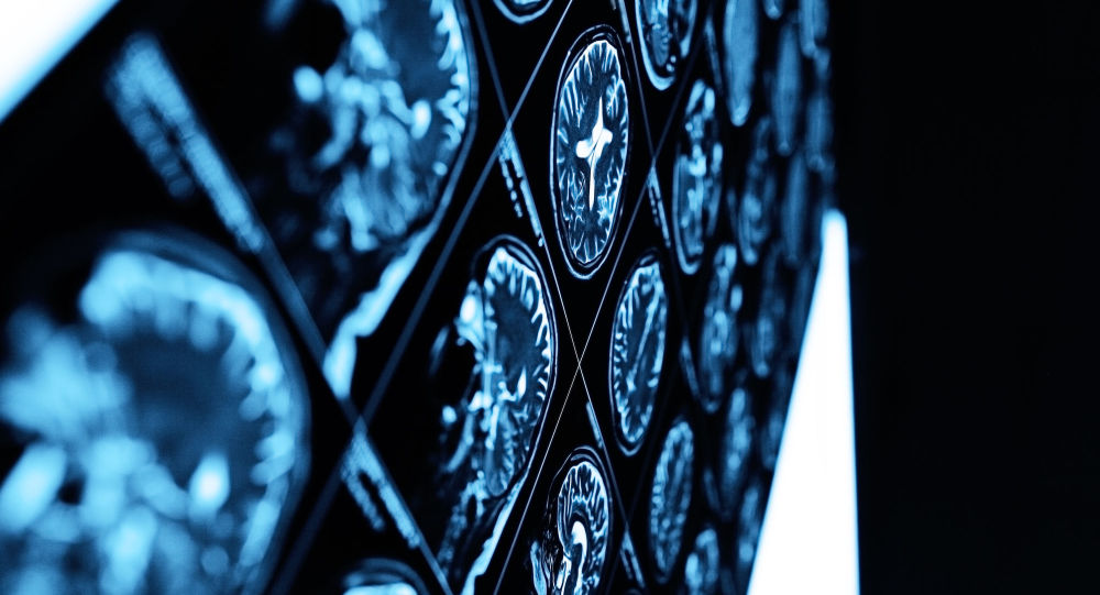 عوارض کرونا همچنان به روز می شود عوارض کرونا همچنان به روز می شود