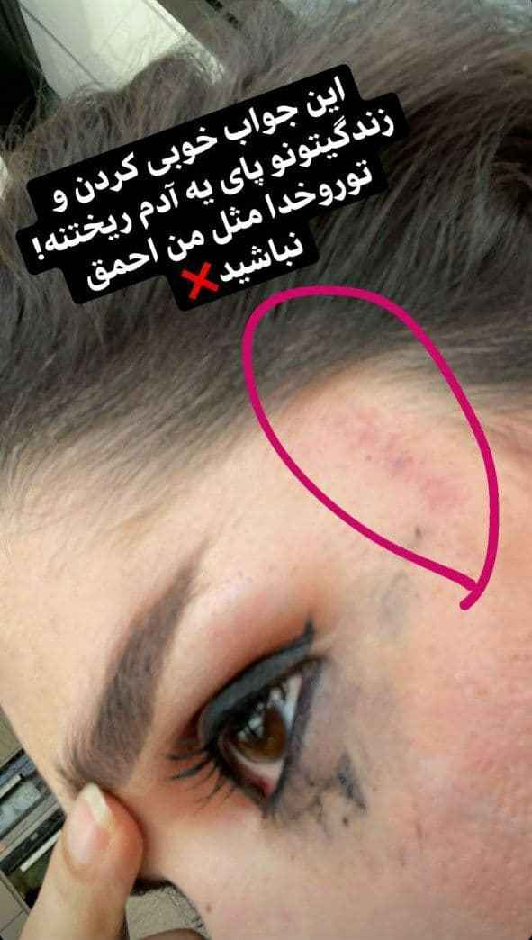 کتک خوردن دنیا جهانبخت از مهراد جم/عکس کتک خوردن دنیا جهانبخت از مهراد جم/عکس