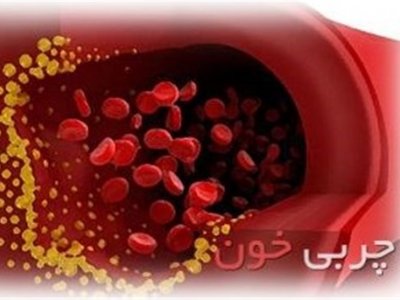 این علائم به شما می‌گوید چربی خون دارید