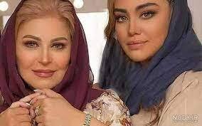 تغییر چهره شگفت آور اکرم محمدي، بازیگر (عکس)