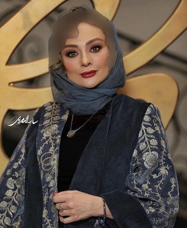 چهره مصنوعی یکتا ناصر با عمل هایی زیبایی/عکس