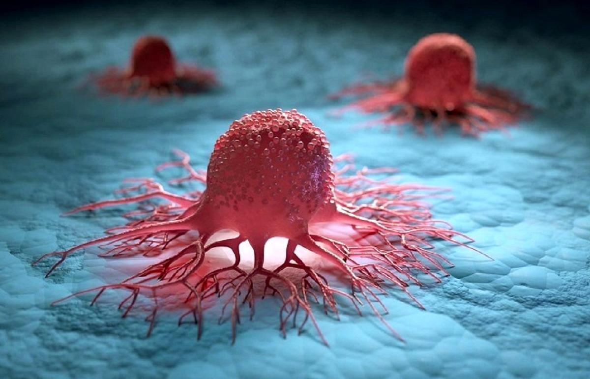 کاهش ابتلا به سرطان با مصرف این ماده غذایی کاهش ابتلا به سرطان با مصرف این ماده غذایی