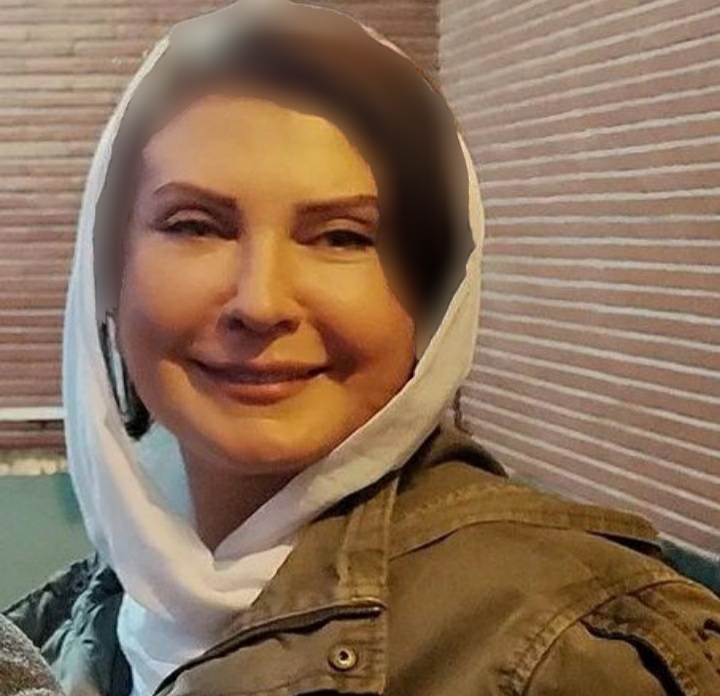 زیرو رو شدن چهره لعیا زنگنه بعد از عمل زیبایی/عکس زیرو رو شدن چهره لعیا زنگنه بعد از عمل زیبایی/عکس