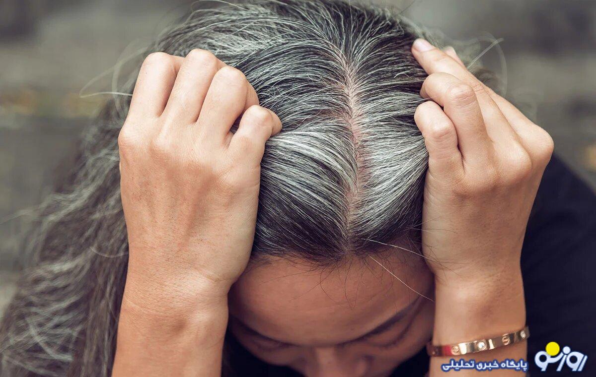 برای جلوگیری از سفید شدن موی سر چه باید کرد؟